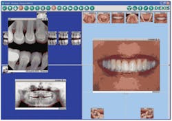 Th 0705deexc01 Th 0705deexc01