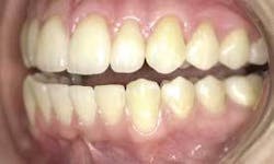 Th 0709deaac03 Th 0709deaac03