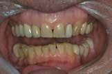 Th 125390 Th 125390