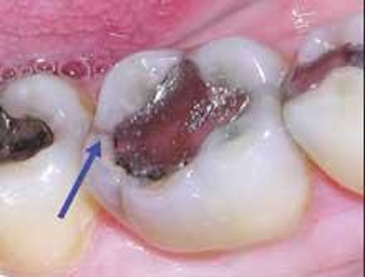 Th 165308