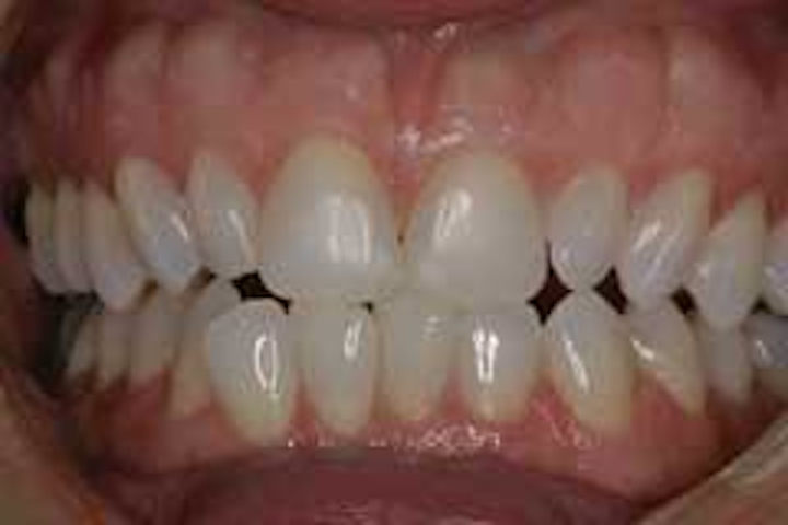 Th 172669