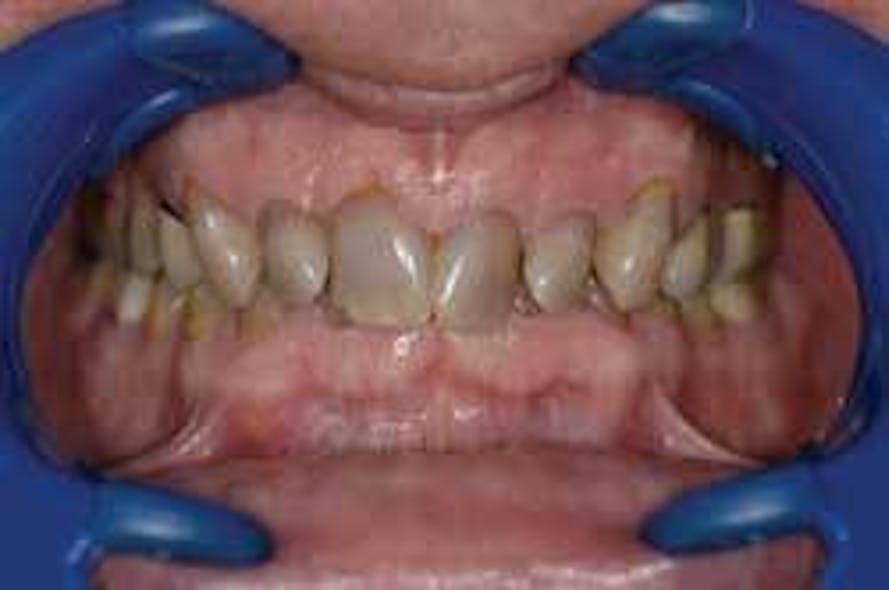 Th 209100