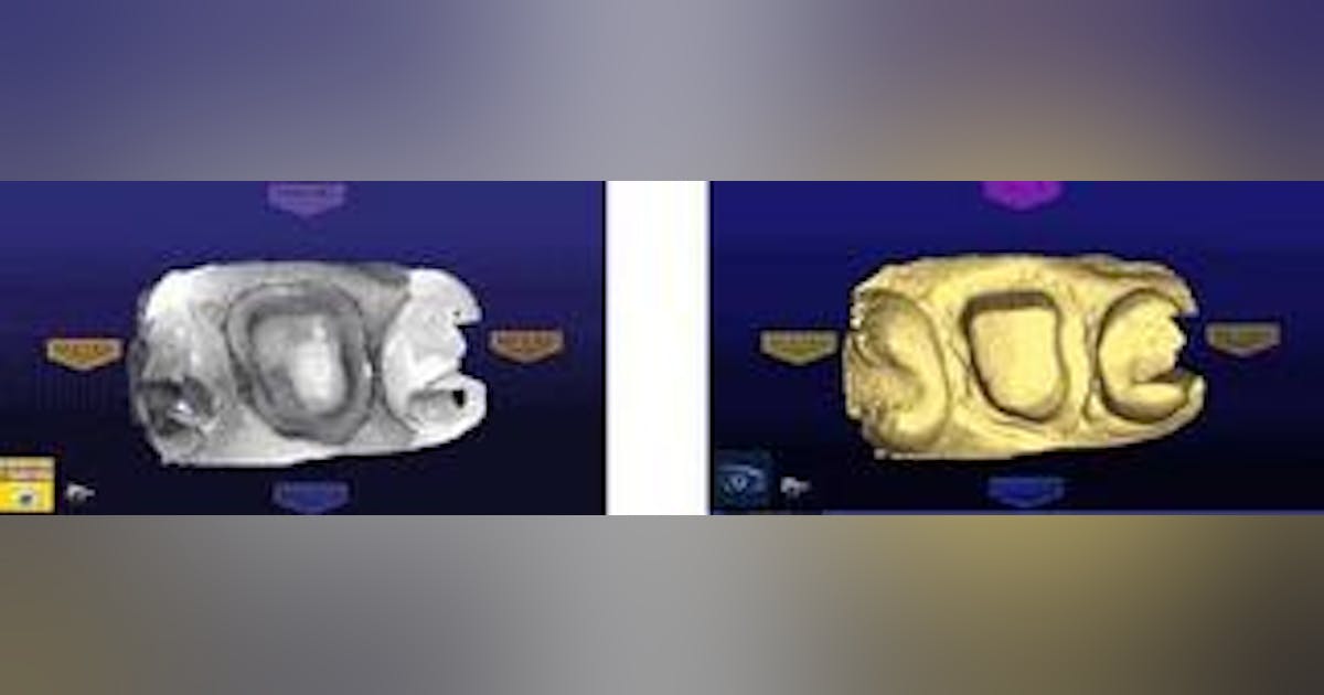 Wowing the patient with chairside CAD/CAM | Dental Economics
