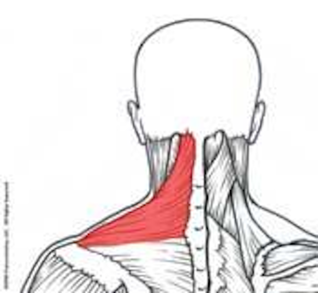 Trapezius myalgia making dentistry a pain in the neck — or head