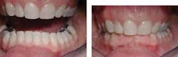 Th 289875 Th 289875