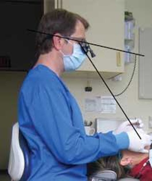 Ergonomically Optimal Loupes Support Proper Practice Posture - Decisions in  Dentistry