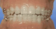 Th 317005 Th 317005