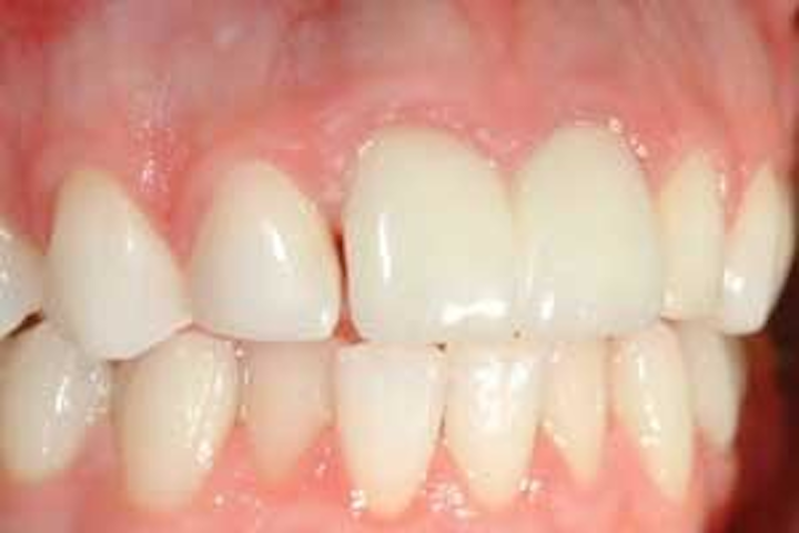 Th 328582
