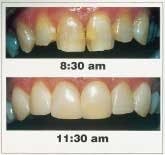 Th 9102de115 Th 9102de115