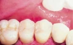 Th 9103deda4 Th 9103deda4