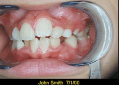 Th De109792 31 Th De109792 31