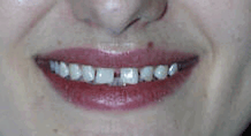 Th De109844 14