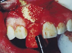 Th De111045 38 Th De111045 38