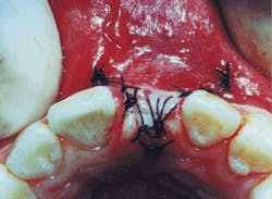 Th De111045 39 Th De111045 39