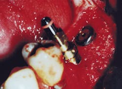 Th De111045 44 Th De111045 44