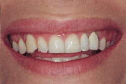 Th De116627 27 Th De116627 27