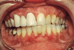 Th De122256 28 Th De122256 28