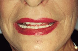 Th De122259 30 Th De122259 30