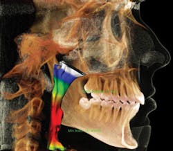 Toc Guy De October 2013 Image Airway2 Toc Guy De October 2013 Image Airway2