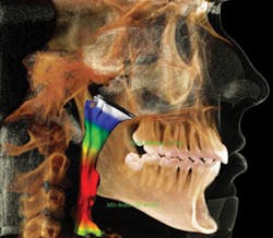 Toc Guy De October 2013 Image Airway2 Toc Guy De October 2013 Image Airway2