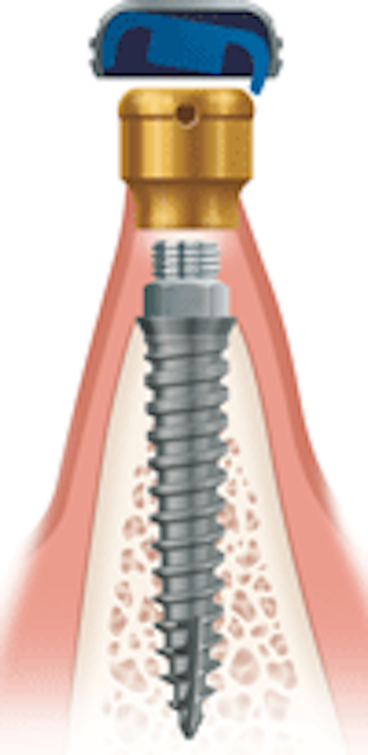 Toc Pareshfig1