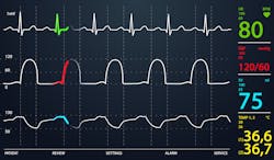 Vitalsigns Vitalsigns