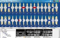Wdentimax Image Charting Screen For Dental Econmics