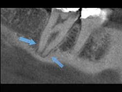 1603dechr P04 1603dechr P04