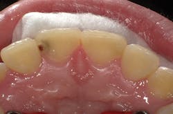 1603dekam P01 1603dekam P01