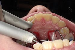 1603dekam P02 1603dekam P02