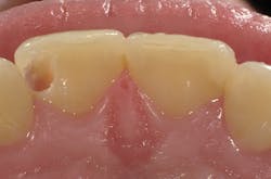 1603dekam P03 1603dekam P03