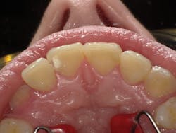 1603dekam P04 1603dekam P04