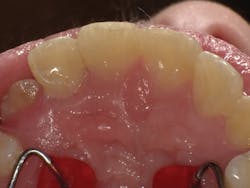 1603dekam P05 1603dekam P05