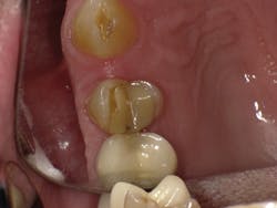 1603dekam P06 1603dekam P06