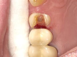 1603dekam P07 1603dekam P07