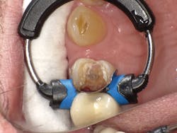 1603dekam P08 1603dekam P08