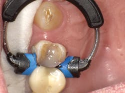 1603dekam P09 1603dekam P09