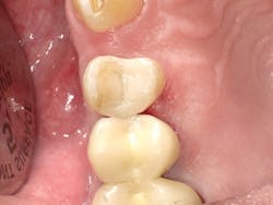 1603dekam P10 1603dekam P10