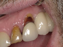 1603dekam P11 1603dekam P11