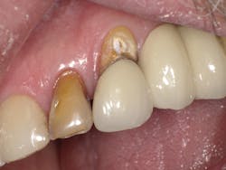 1603dekam P12 1603dekam P12