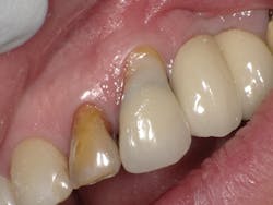 1603dekam P13 1603dekam P13