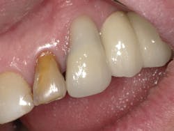 1603dekam P14 1603dekam P14