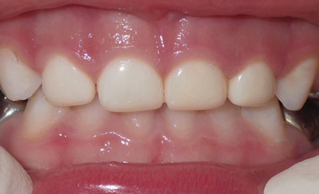 Read Download Crowns In Pediatric Dentistry Organizational