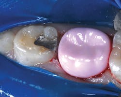 1603dewag P04 1603dewag P04