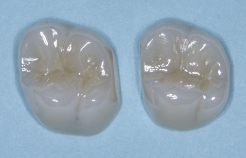1604dechr P01