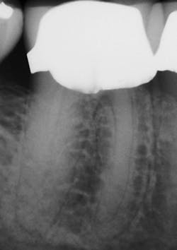 1604dedeu P04 1604dedeu P04