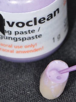 1604defgn P03 1604defgn P03