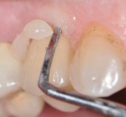 1604defgn P05 1604defgn P05