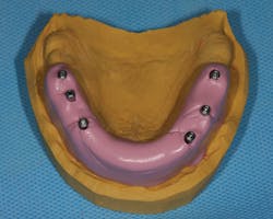 1604depam P04 1604depam P04