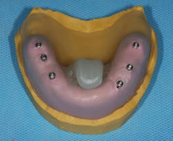 1604depam P06 1604depam P06